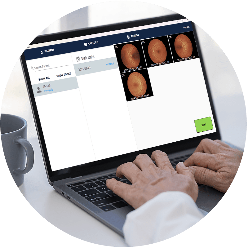 VitaziMD ophthalmologist reading scans