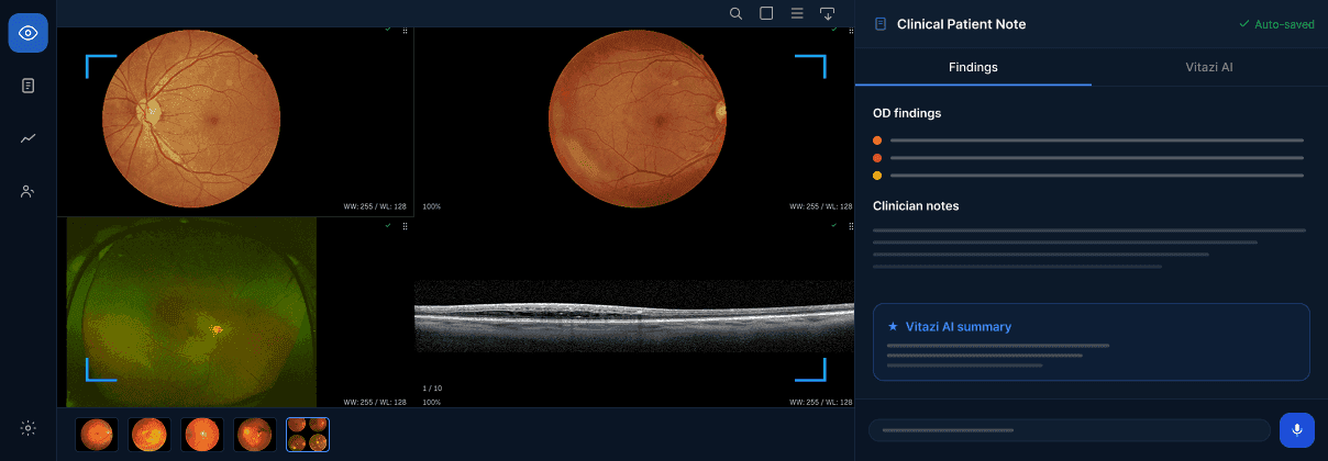 Vitazi Image Hub Fundus Review